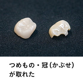 つめもの、冠（かぶせ）がとれた