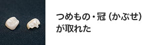 つめもの、冠（かぶせ）がとれた