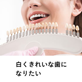 白く綺麗な歯になりたい